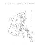 IMPLANTABLE DEVICE FOR THE TREATMENT OF OBESITY diagram and image