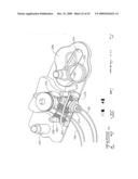 IMPLANTABLE DEVICE FOR THE TREATMENT OF OBESITY diagram and image