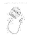 CATHETER WITH RADIOPAQUE MARKER diagram and image