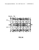 Lightweight surgical mesh diagram and image