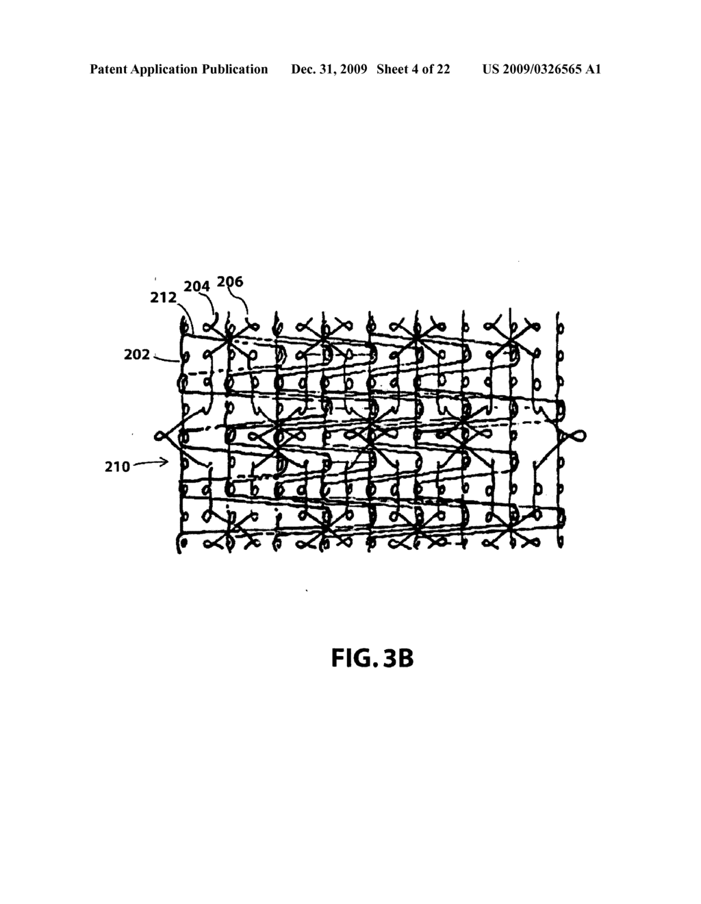 Lightweight surgical mesh - diagram, schematic, and image 05