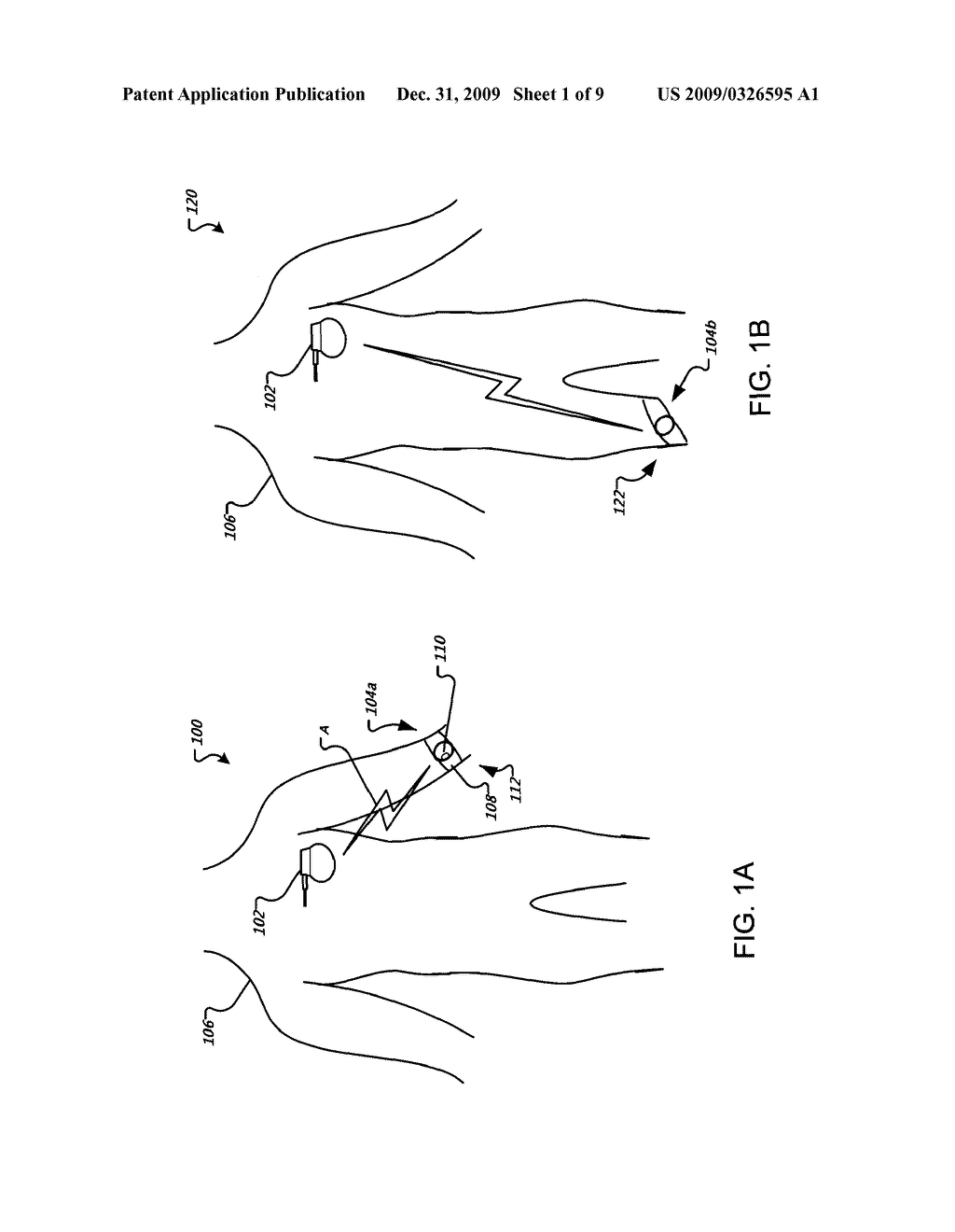 Prediction and Prevention of Cardiovascular Insult - diagram, schematic, and image 02