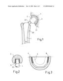 INSERTION OF VIBRATION-DAMPING ELEMENTS IN PROSTHETIC SYSTEMS FOR THE MANIPULATION AND DAMPING OF NATURAL FREQUENCIES diagram and image