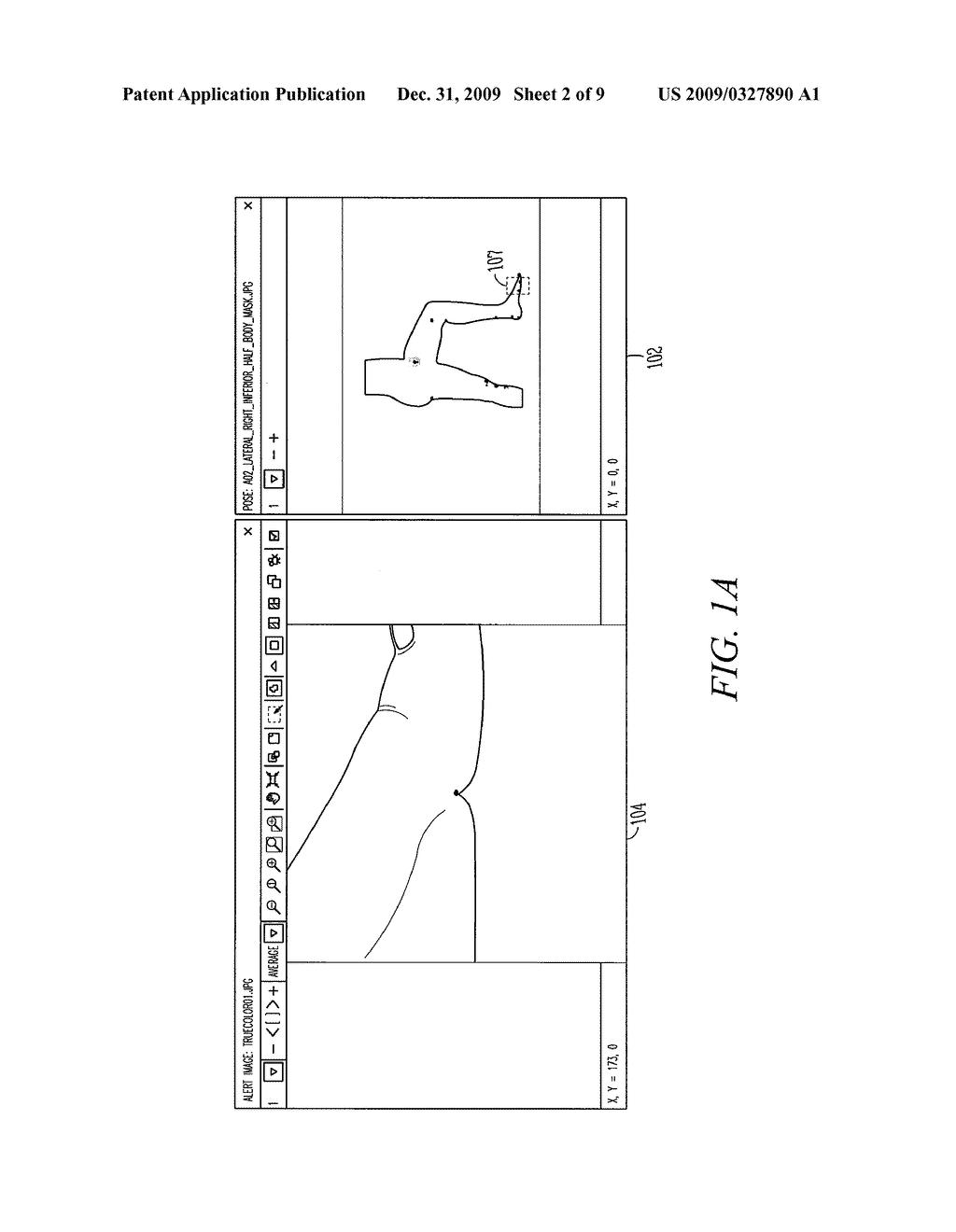 GRAPHICAL USER INTERFACE (GUI), DISPLAY MODULE AND METHODS FOR DISPLAYING AND COMPARING SKIN FEATURES - diagram, schematic, and image 03