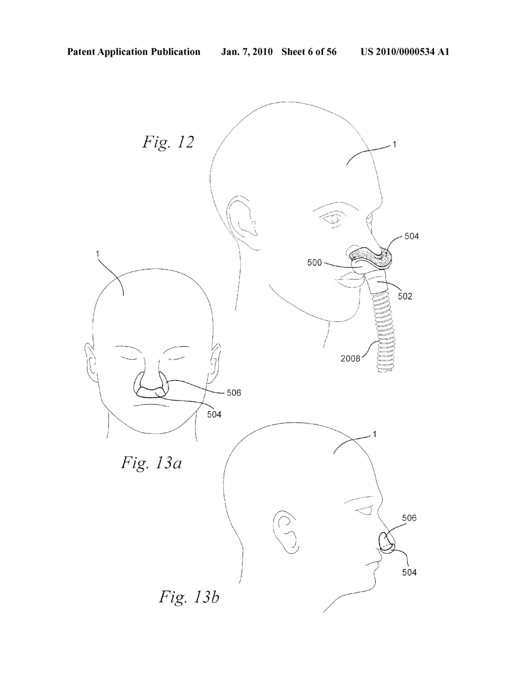 PATIENT INTERFACE SYSTEMS - diagram, schematic, and image 07