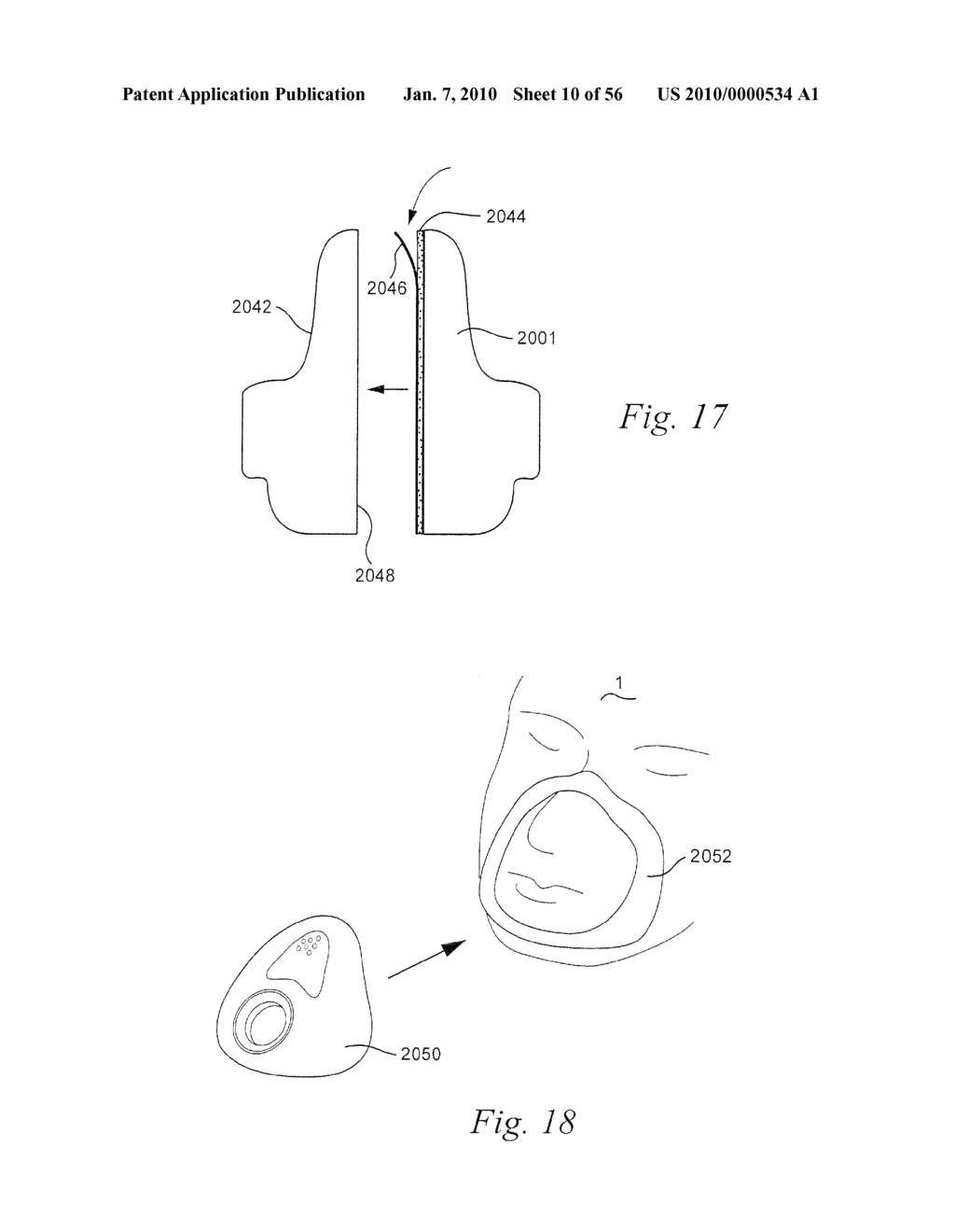 PATIENT INTERFACE SYSTEMS - diagram, schematic, and image 11