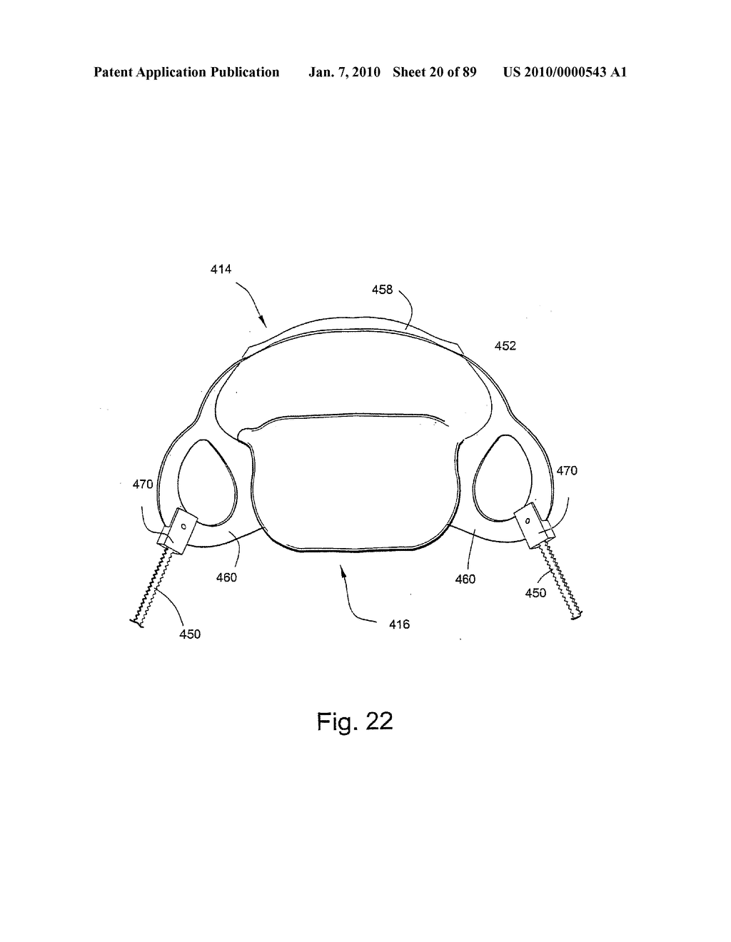 Mask and components thereof - diagram, schematic, and image 21