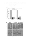 Diagnosis of nasopharyngeal carcinoma and suppression of nasopharyngeal carcinoma invasion diagram and image