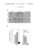 Diagnosis of nasopharyngeal carcinoma and suppression of nasopharyngeal carcinoma invasion diagram and image