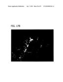 Reduction of Ophthalmalogic Neovascularization diagram and image