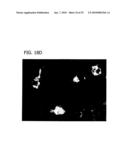 Reduction of Ophthalmalogic Neovascularization diagram and image