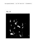 Reduction of Ophthalmalogic Neovascularization diagram and image