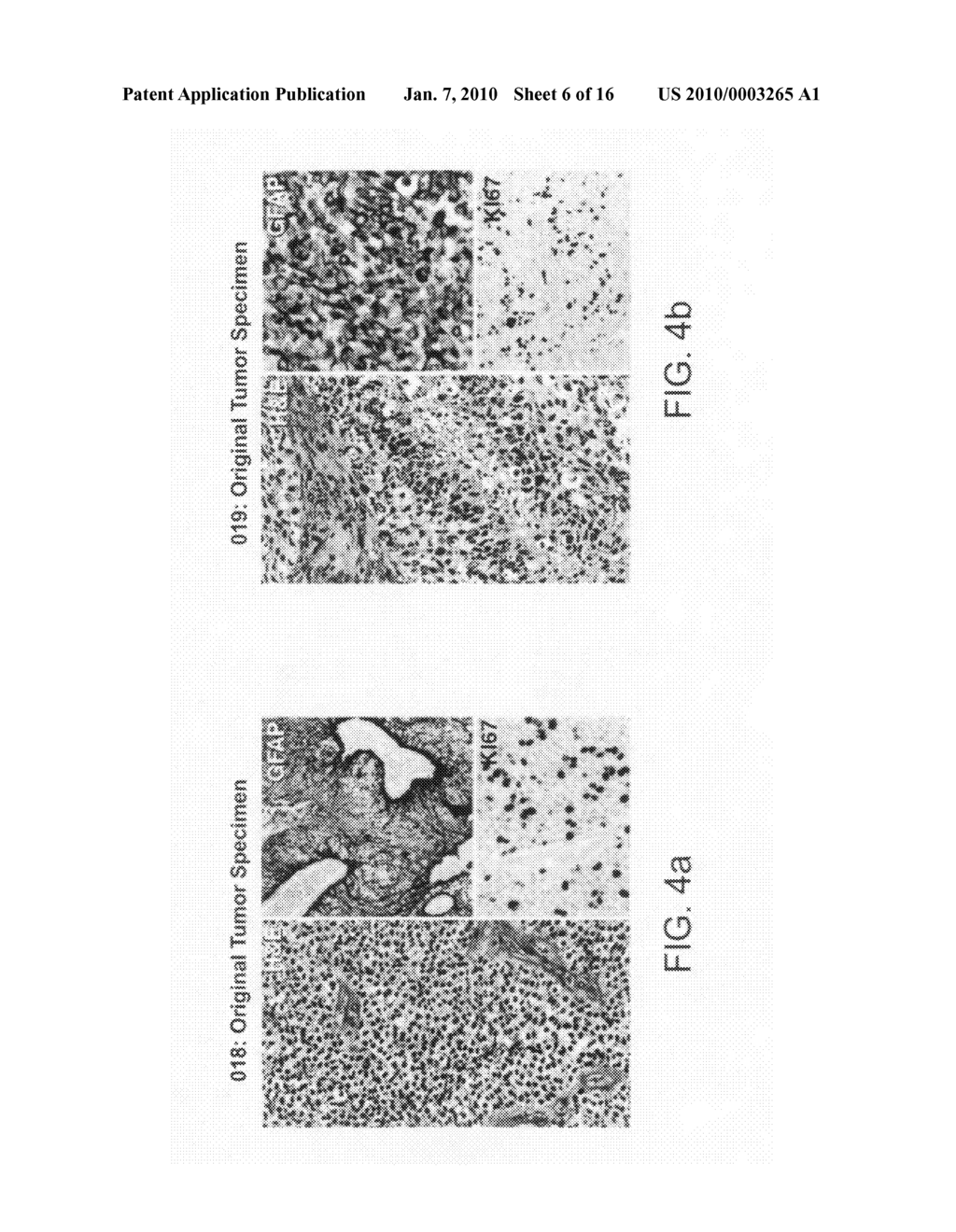 Isolation, expansion and uses of tumor stem cells - diagram, schematic, and image 07