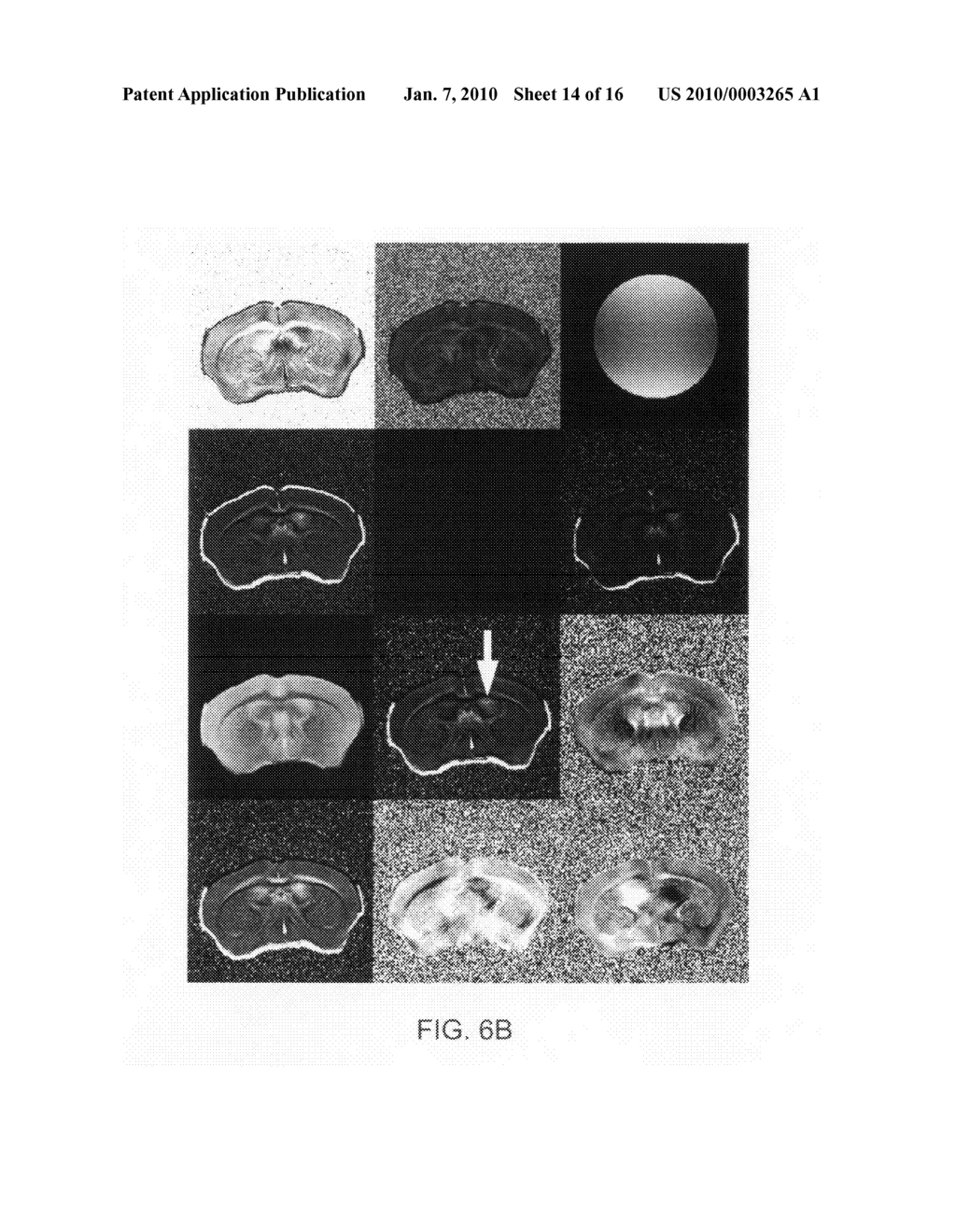 Isolation, expansion and uses of tumor stem cells - diagram, schematic, and image 15