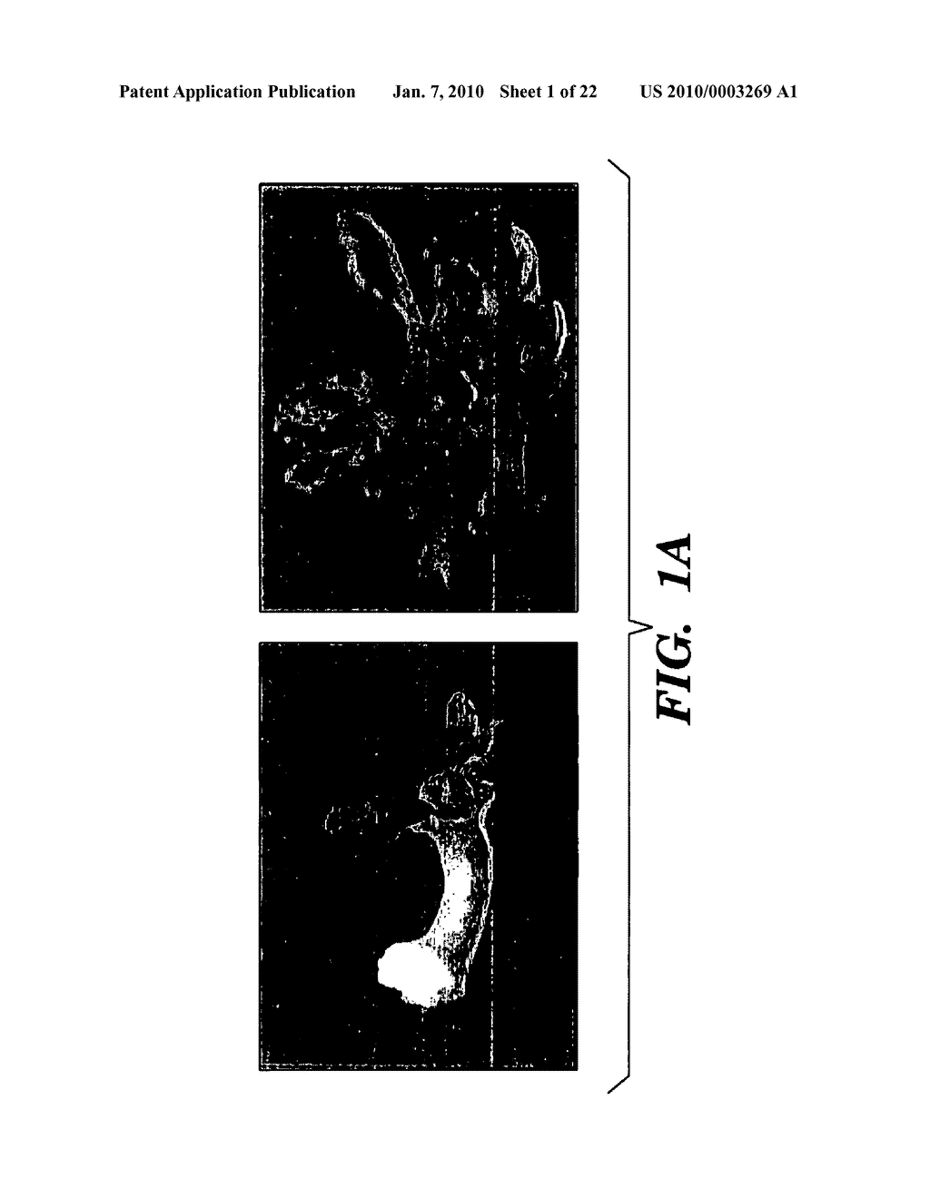 METHODS AND USES OF CAULIFLOWER AND COLLARD FOR RECOMBINANT PROTEIN PRODUCTION - diagram, schematic, and image 02