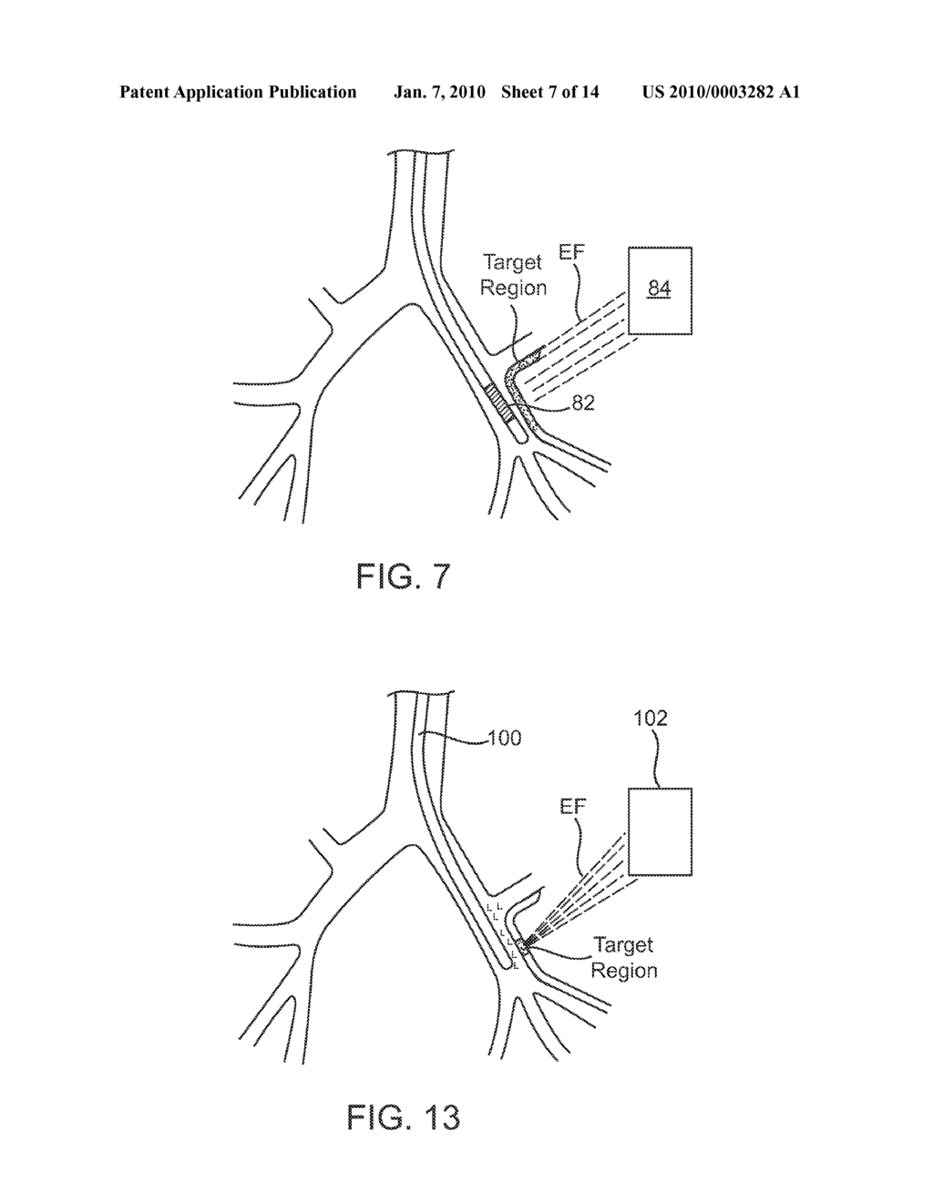 SYSTEMS AND METHODS FOR DELIVERY OF A THERAPEUTIC AGENT - diagram, schematic, and image 08