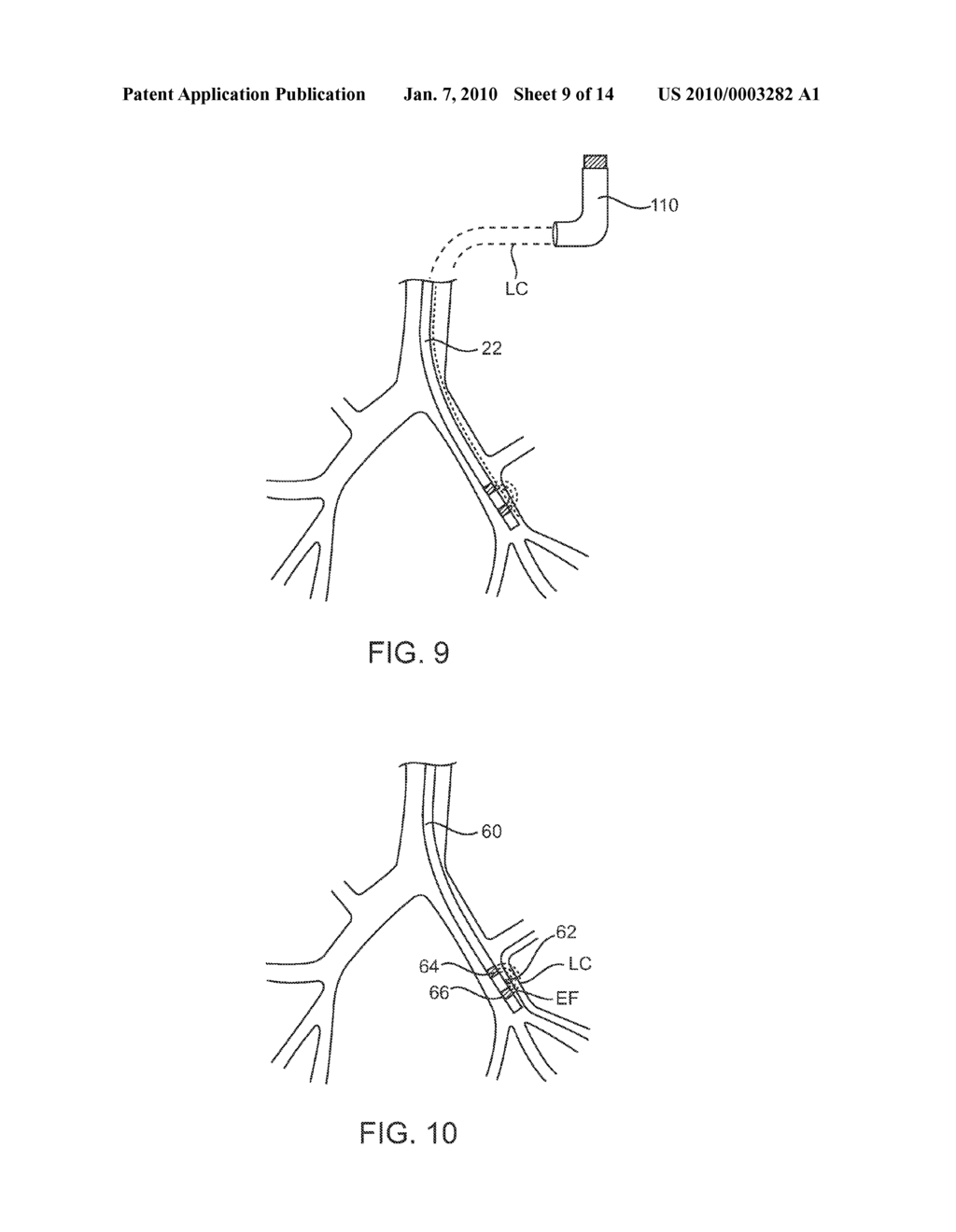 SYSTEMS AND METHODS FOR DELIVERY OF A THERAPEUTIC AGENT - diagram, schematic, and image 10