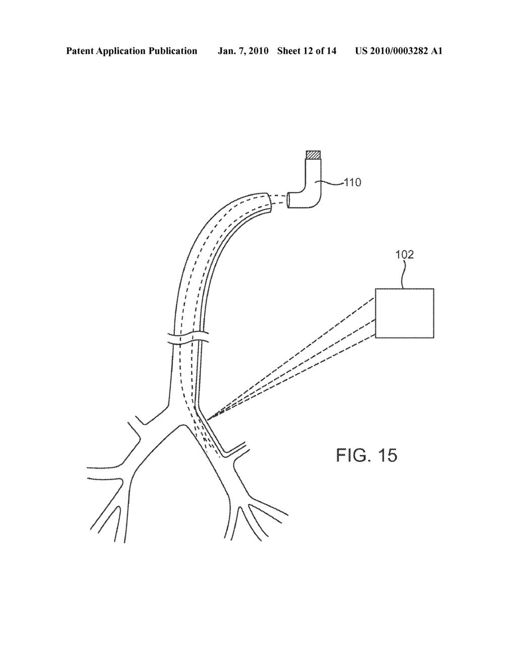 SYSTEMS AND METHODS FOR DELIVERY OF A THERAPEUTIC AGENT - diagram, schematic, and image 13