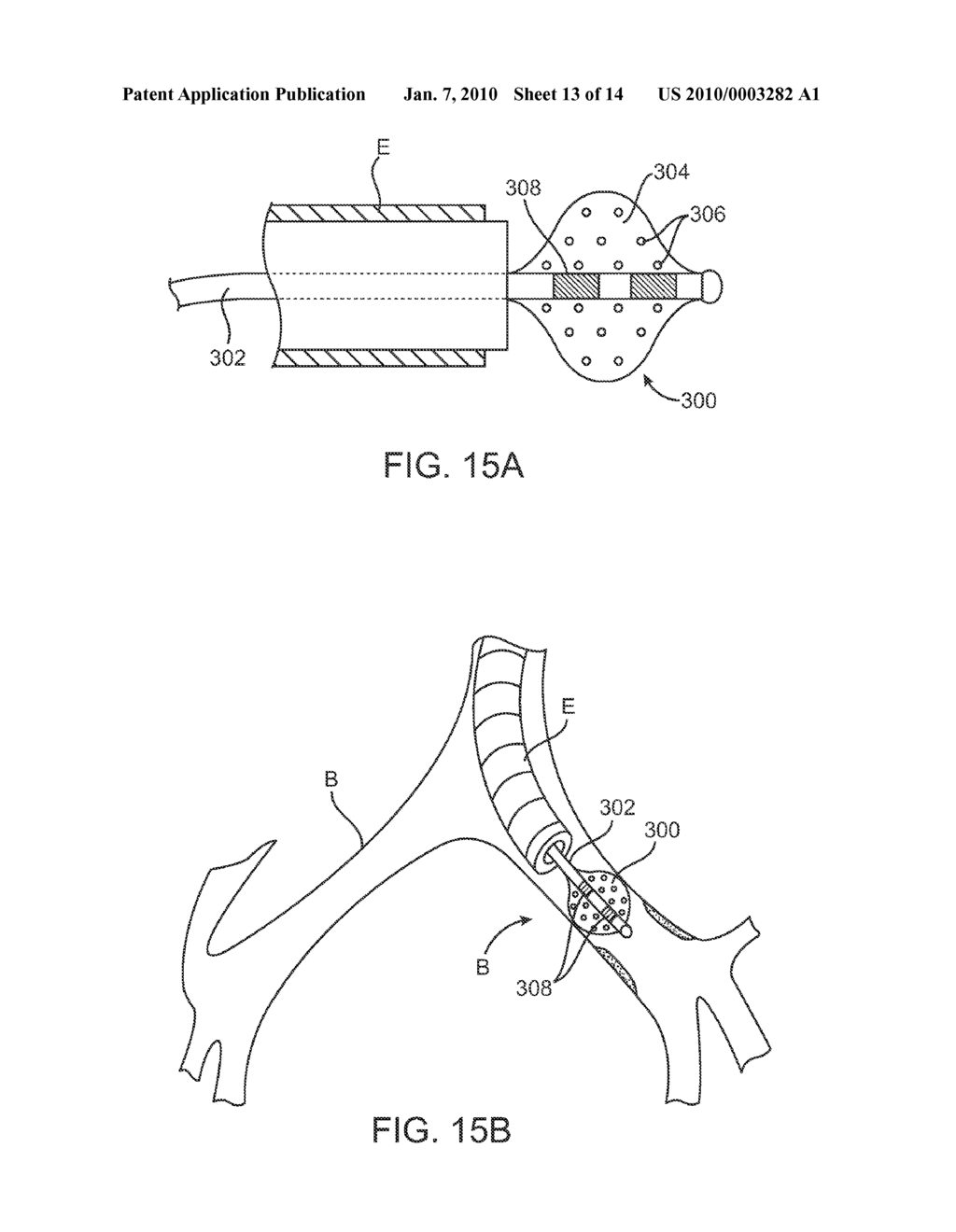 SYSTEMS AND METHODS FOR DELIVERY OF A THERAPEUTIC AGENT - diagram, schematic, and image 14