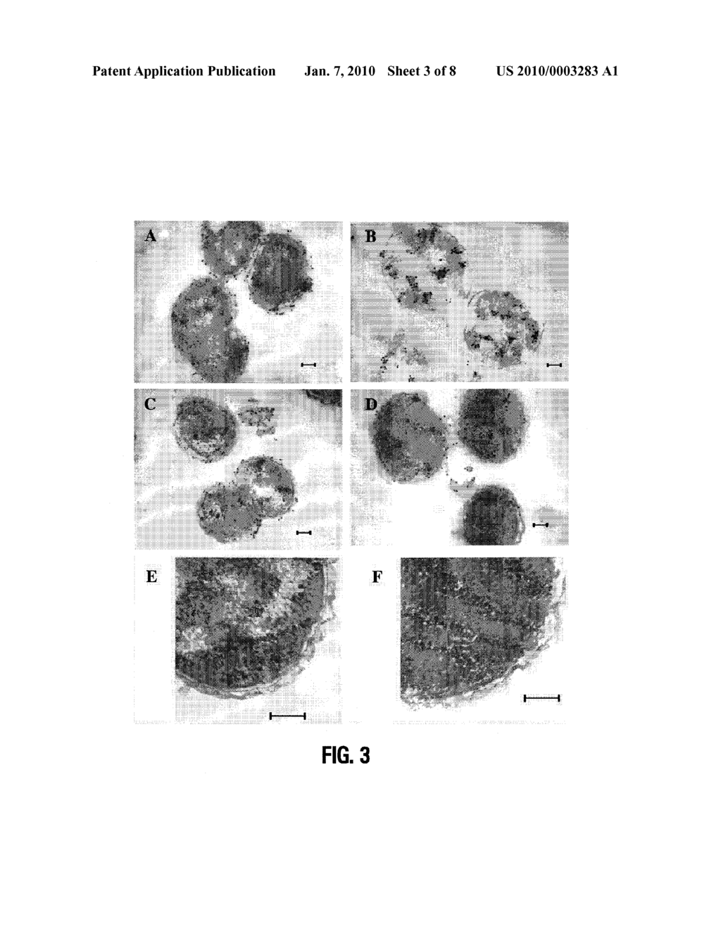 LIPID A DEFICIENT MUTANTS OF NEISSERIA MENINGITIDIS - diagram, schematic, and image 04