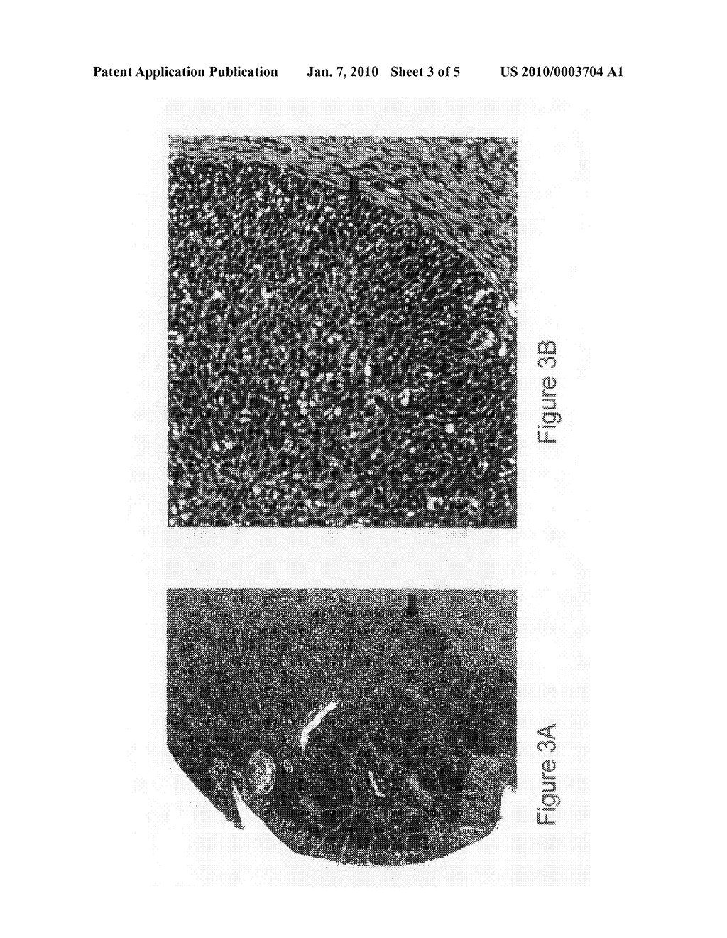 IN SITU detection of early stages and late stages HPV infection - diagram, schematic, and image 04