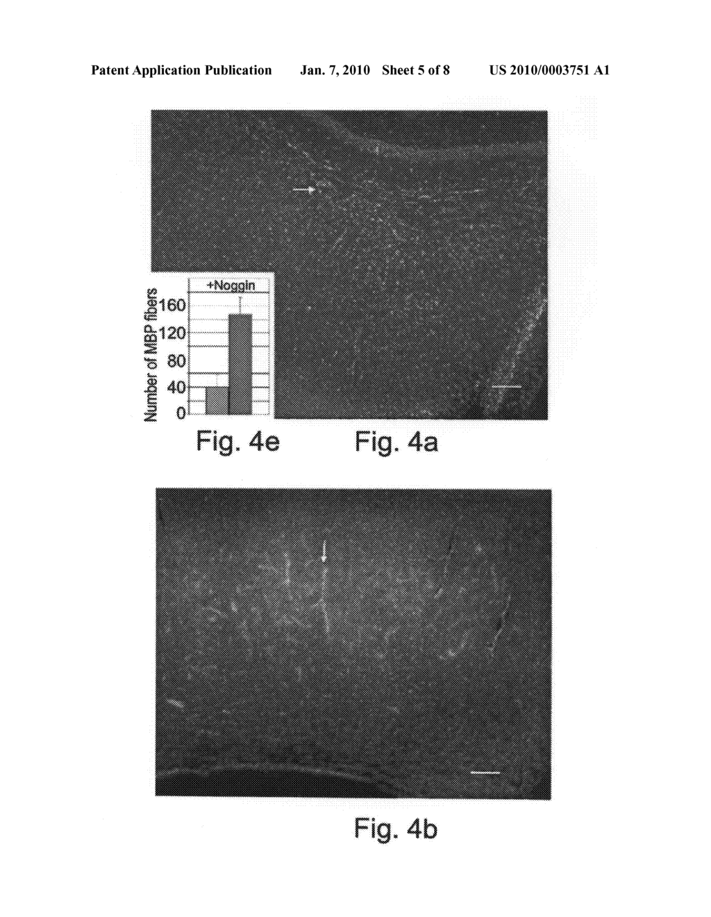 Methods of generating glial and neuronal cells and use of same for the treatment of medical conditions of the cns - diagram, schematic, and image 06