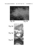 Methods of generating glial and neuronal cells and use of same for the treatment of medical conditions of the cns diagram and image