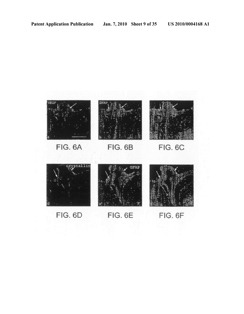 Use of Crystallin For The Modulation of Angiogenesis - diagram, schematic, and image 10