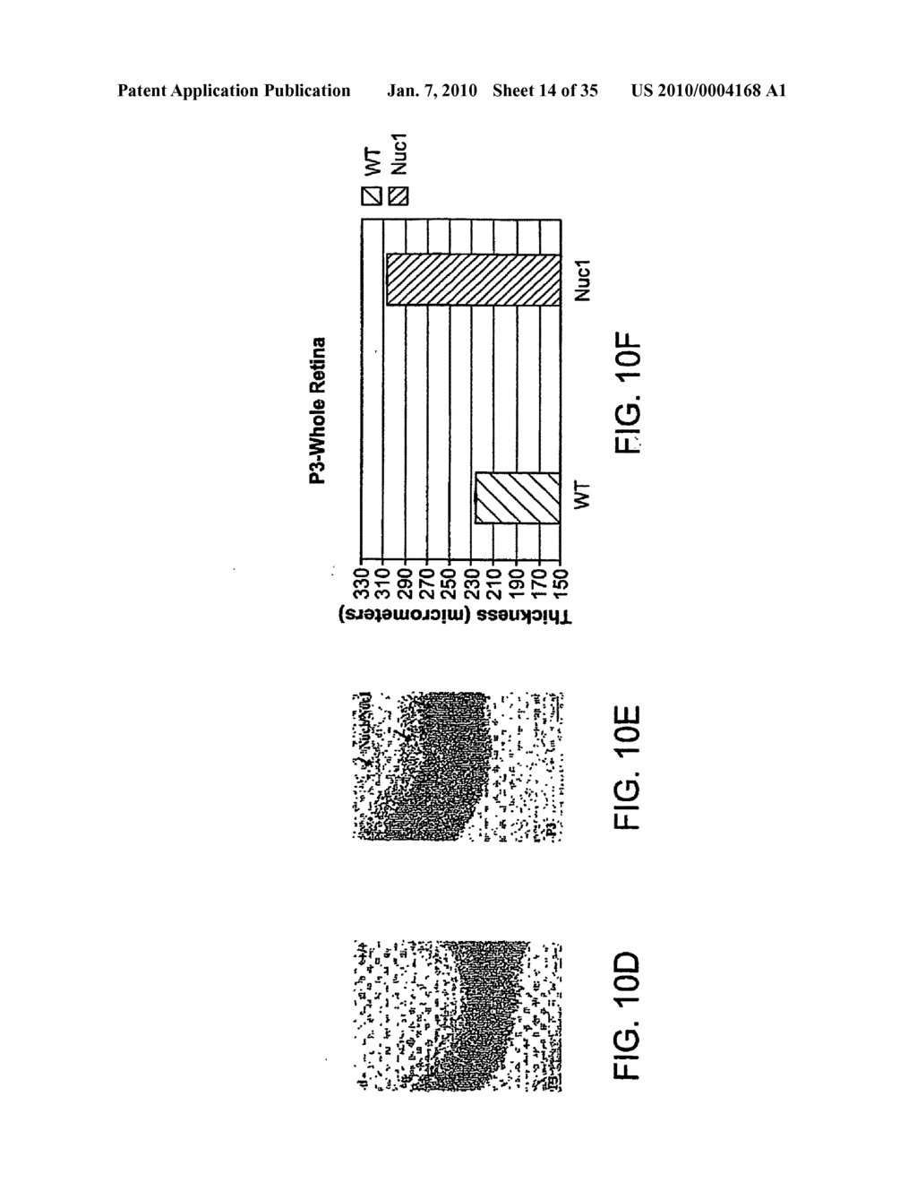 Use of Crystallin For The Modulation of Angiogenesis - diagram, schematic, and image 15