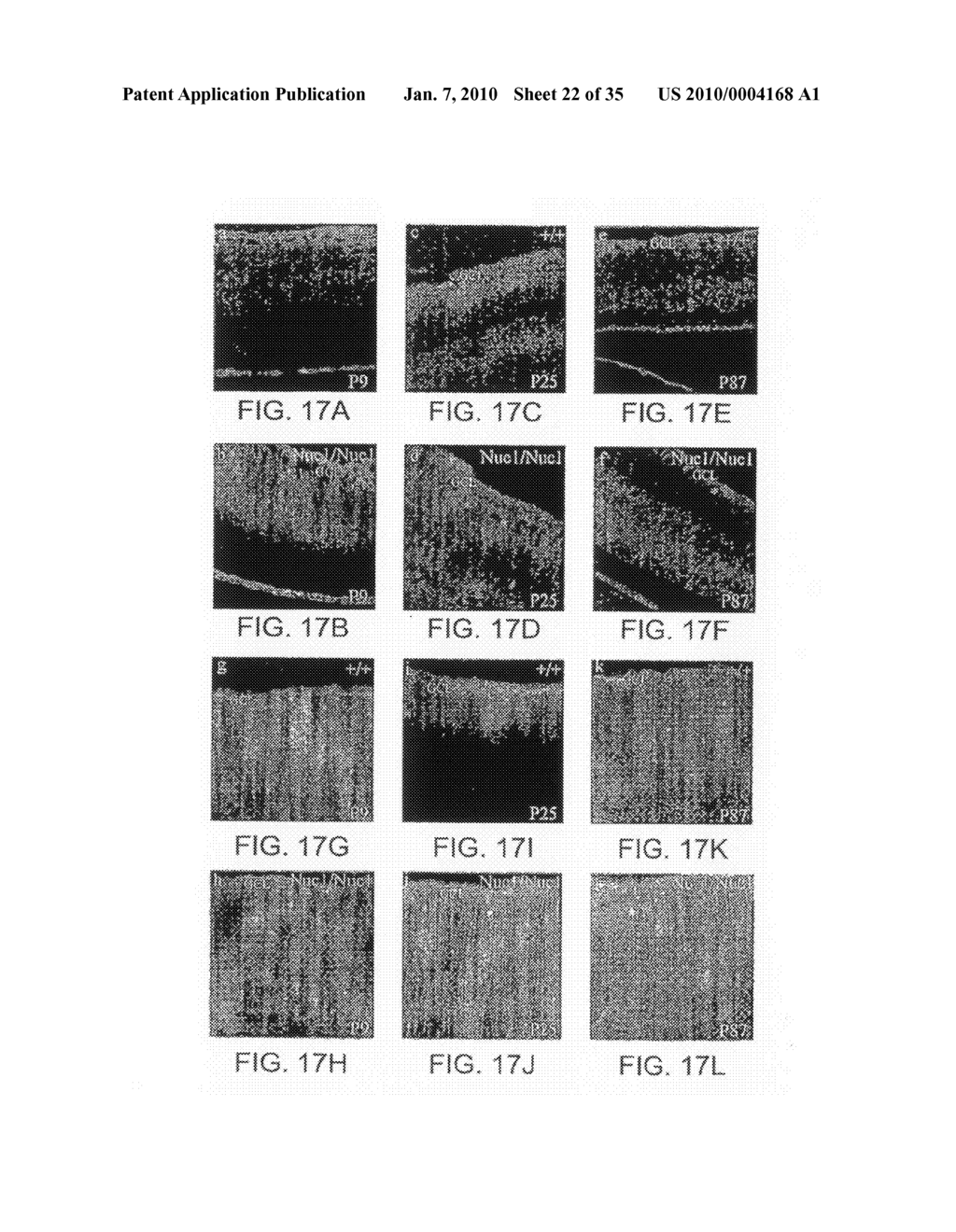 Use of Crystallin For The Modulation of Angiogenesis - diagram, schematic, and image 23