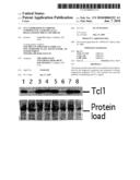 TCL1 Expression in Chronic Lymphocytic Leukemia (CLL) Regulated by MIR-29 and MIR-181 diagram and image