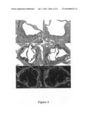 COMPOSITIONS AND METHODS FOR TREATING CARDIOVASCULAR DISORDERS diagram and image