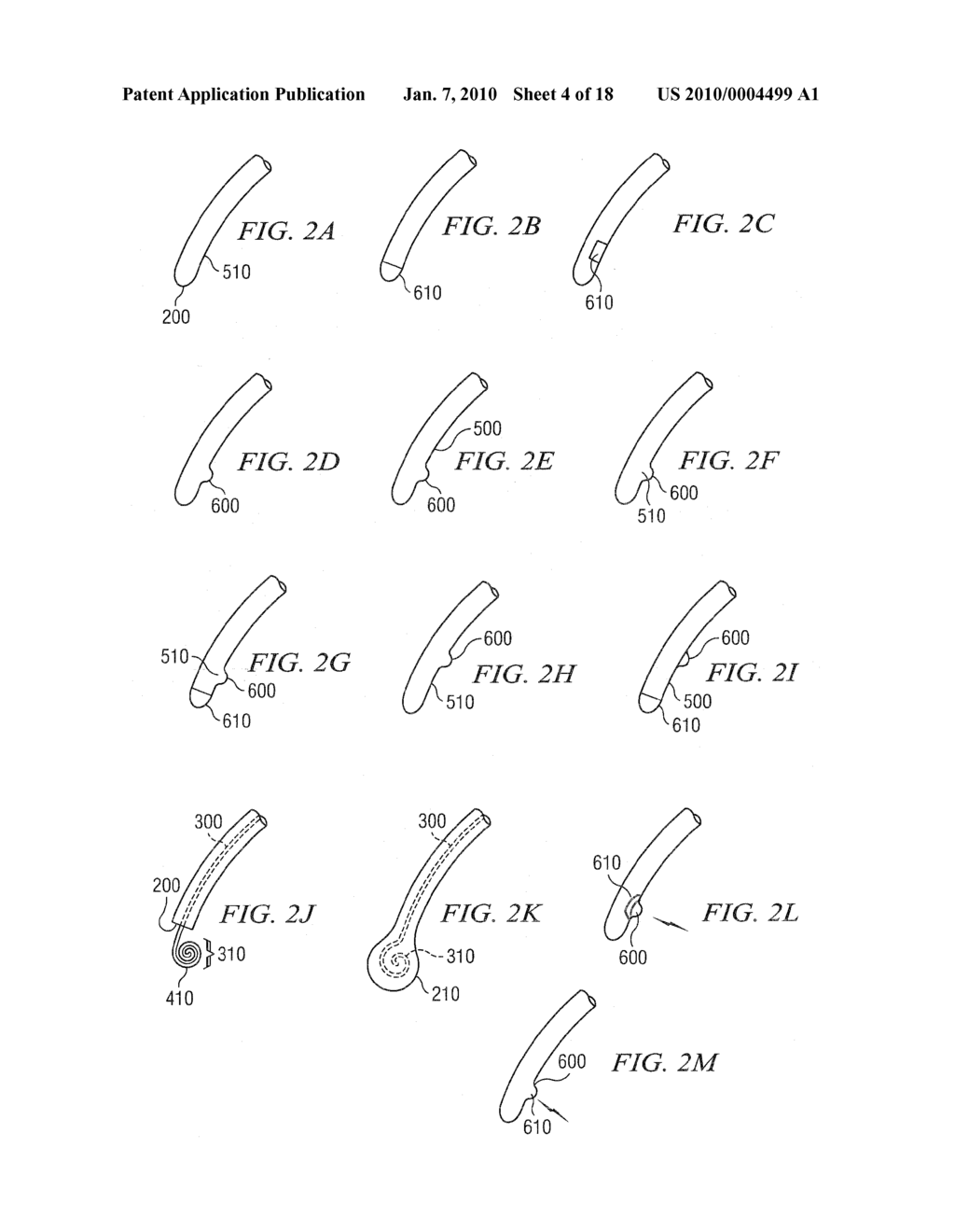 Methods And Devices For Minimally-Invasive Extraocular Delivery of Radiation To The Posterior Portion Of The Eye - diagram, schematic, and image 05