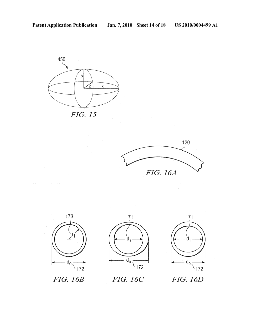 Methods And Devices For Minimally-Invasive Extraocular Delivery of Radiation To The Posterior Portion Of The Eye - diagram, schematic, and image 15