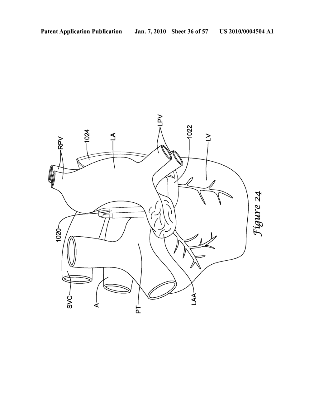 EPICARDIAL CLIP - diagram, schematic, and image 37