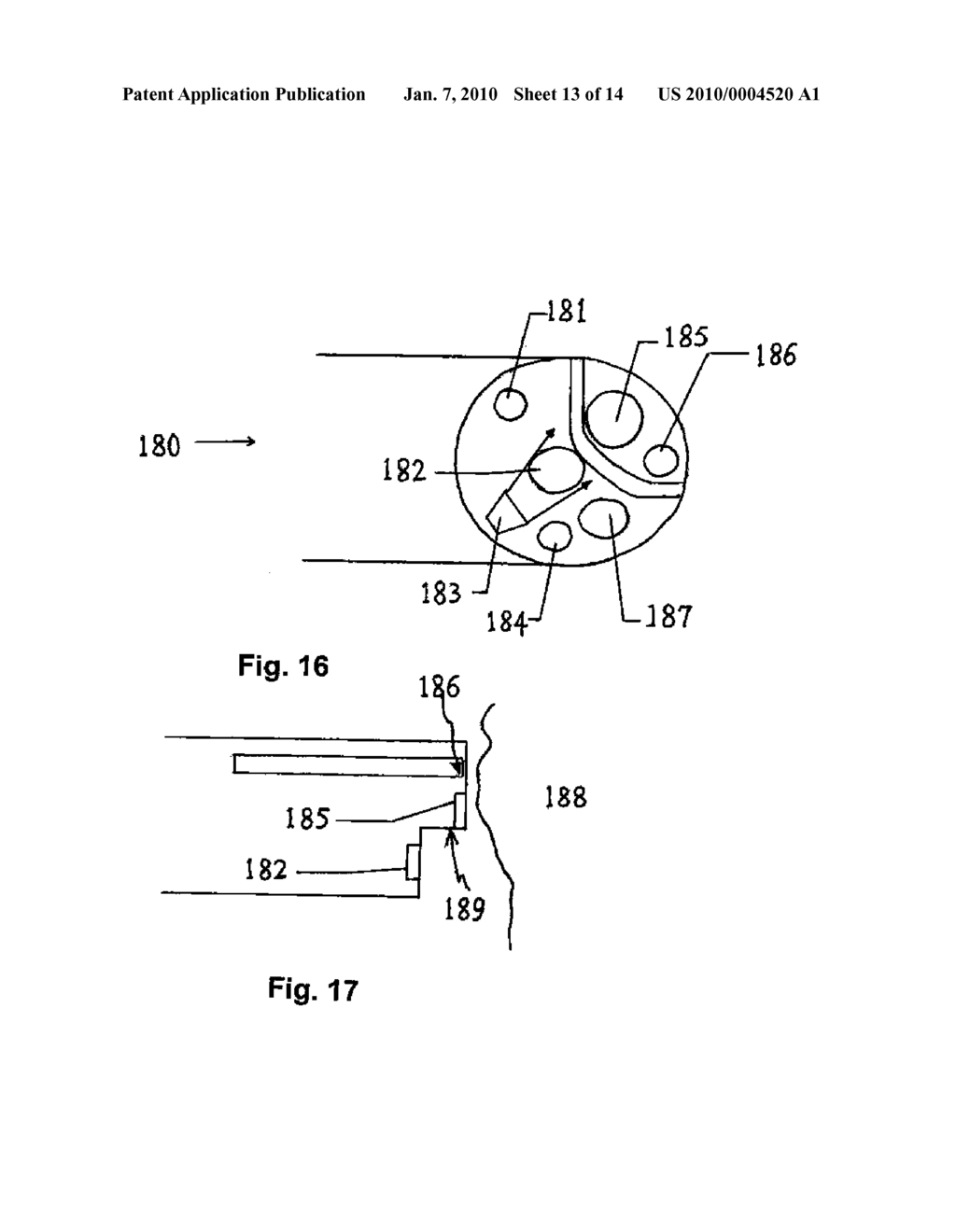 Method and Apparatus for Foreign Matter Detection For Blood Content Sensors - diagram, schematic, and image 14