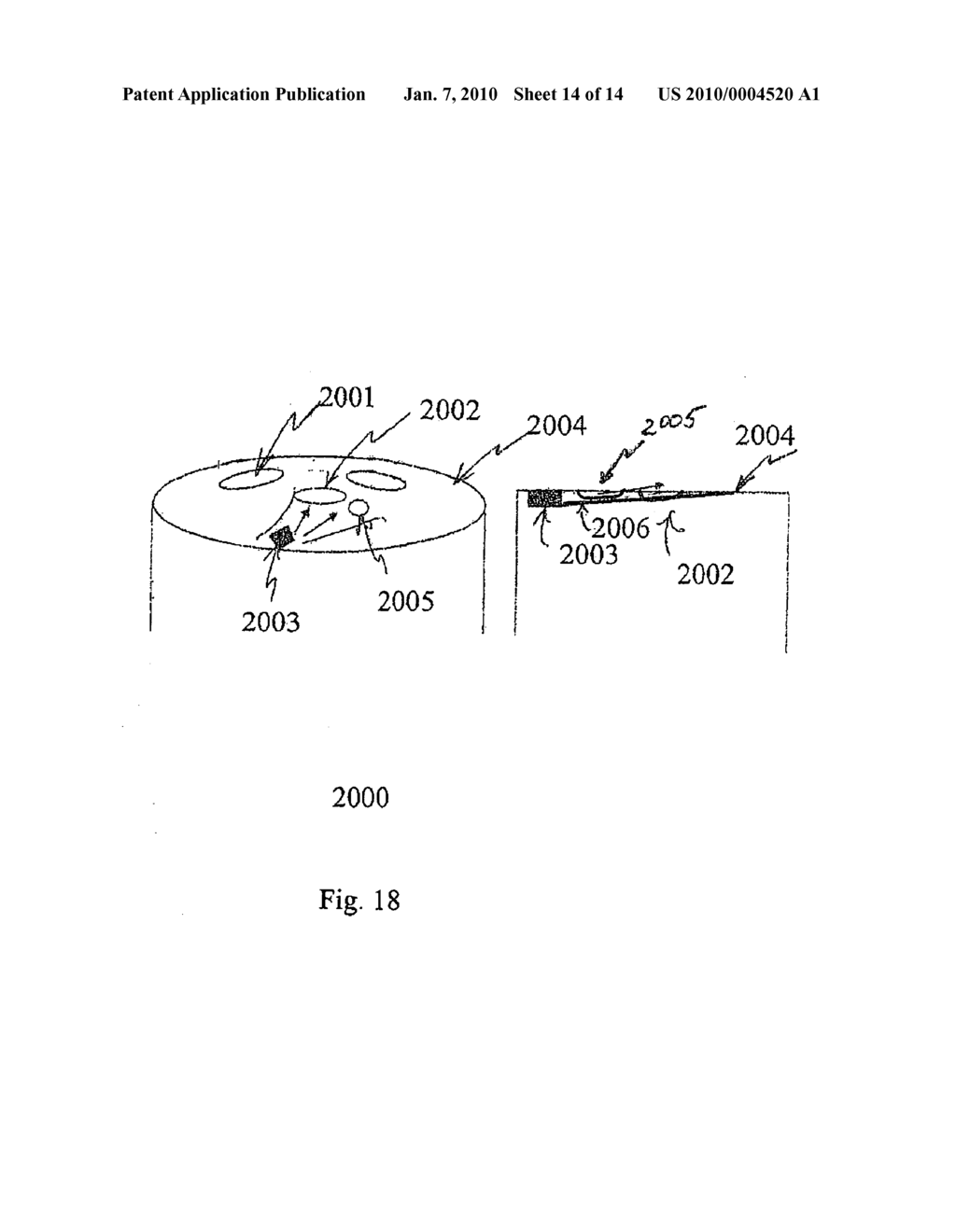 Method and Apparatus for Foreign Matter Detection For Blood Content Sensors - diagram, schematic, and image 15