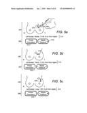 USER INTERFACE FOR ULTRASOUND MAMMOGRAPHIC IMAGING diagram and image