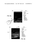 USER INTERFACE FOR ULTRASOUND MAMMOGRAPHIC IMAGING diagram and image