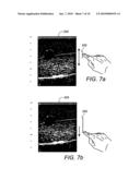 USER INTERFACE FOR ULTRASOUND MAMMOGRAPHIC IMAGING diagram and image