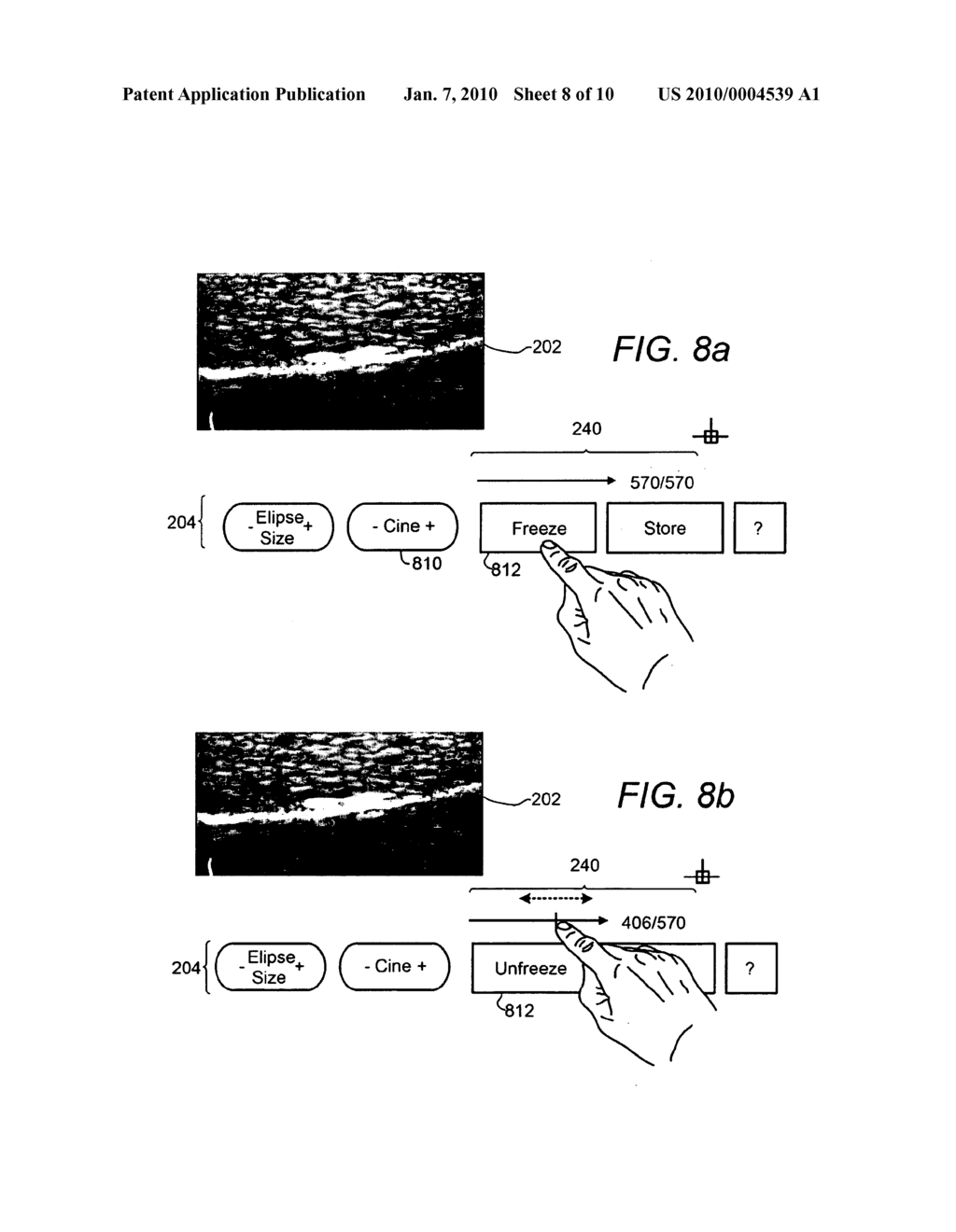 USER INTERFACE FOR ULTRASOUND MAMMOGRAPHIC IMAGING - diagram, schematic, and image 09