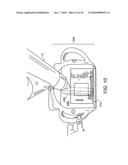 USER INTERFACE FOR ULTRASOUND MAMMOGRAPHIC IMAGING diagram and image