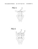 METHOD FOR DIAGNOSIS AND TREATMENT OF PROCESSING DIFFICULTIES, INTEGRATION PROBLEMS, IMBALANCES AND ABNORMAL POSTURES diagram and image