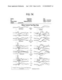 METHOD FOR DIAGNOSIS AND TREATMENT OF PROCESSING DIFFICULTIES, INTEGRATION PROBLEMS, IMBALANCES AND ABNORMAL POSTURES diagram and image