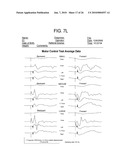 METHOD FOR DIAGNOSIS AND TREATMENT OF PROCESSING DIFFICULTIES, INTEGRATION PROBLEMS, IMBALANCES AND ABNORMAL POSTURES diagram and image