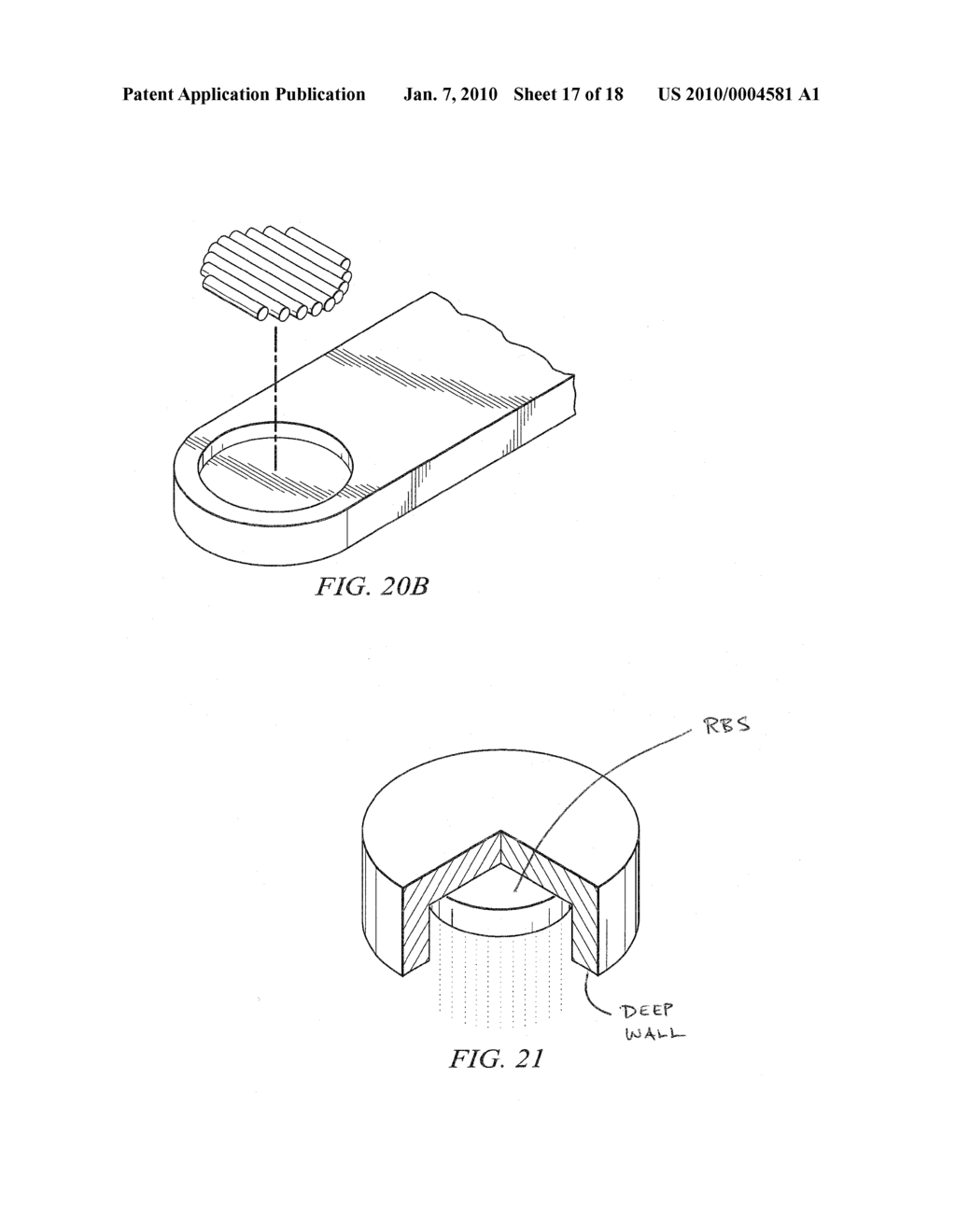 METHODS AND DEVICES FOR MINIMALLY-INVASIVE EXTRAOCULAR DELIVERY OF RADIATION TO THE POSTERIOR PORTION OF THE EYE - diagram, schematic, and image 18