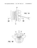 Apparatus and Method for In Vivo Intracellular Transfection of Gene, SIRNA, SHRNA Vectors, and Other Biomedical Diagnostic and Therapeutic Drugs and Molecules for the Treatment of Arthritis and Other Orthopedic Diseases in Large Animals and Humans diagram and image