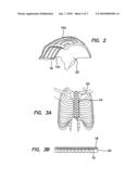 Apparatus and Method for In Vivo Intracellular Transfection of Gene, SIRNA, SHRNA Vectors, and Other Biomedical Diagnostic and Therapeutic Drugs and Molecules for the Treatment of Arthritis and Other Orthopedic Diseases in Large Animals and Humans diagram and image