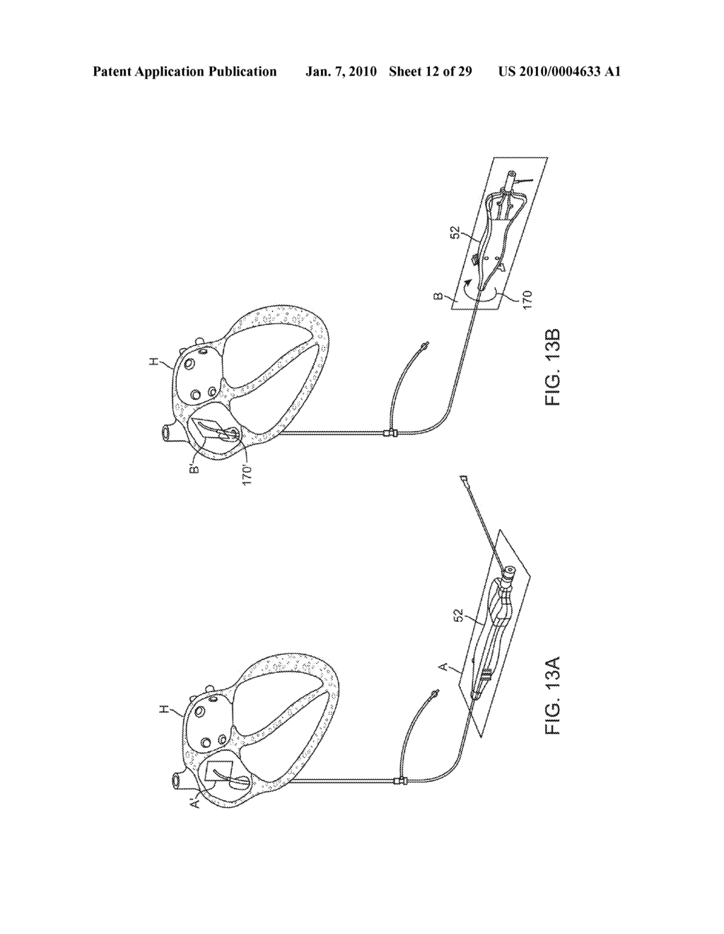 CATHETER CONTROL SYSTEMS - diagram, schematic, and image 13