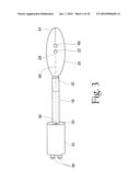 Method to treat gastric reflux via the detection and ablation of gastro-esophageal nerves and receptors diagram and image